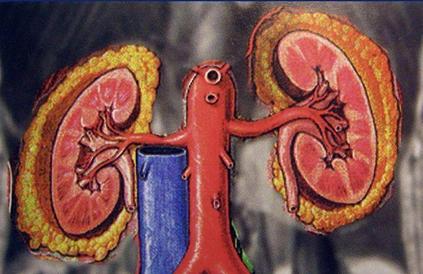 治疗肾动脉狭窄最权威的专家,中医治疗肾动脉狭窄效果好吗