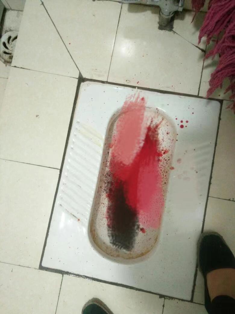 杭州21岁姑娘*夜初**大出血1500ml！无视生命安全，竟在手机找原因