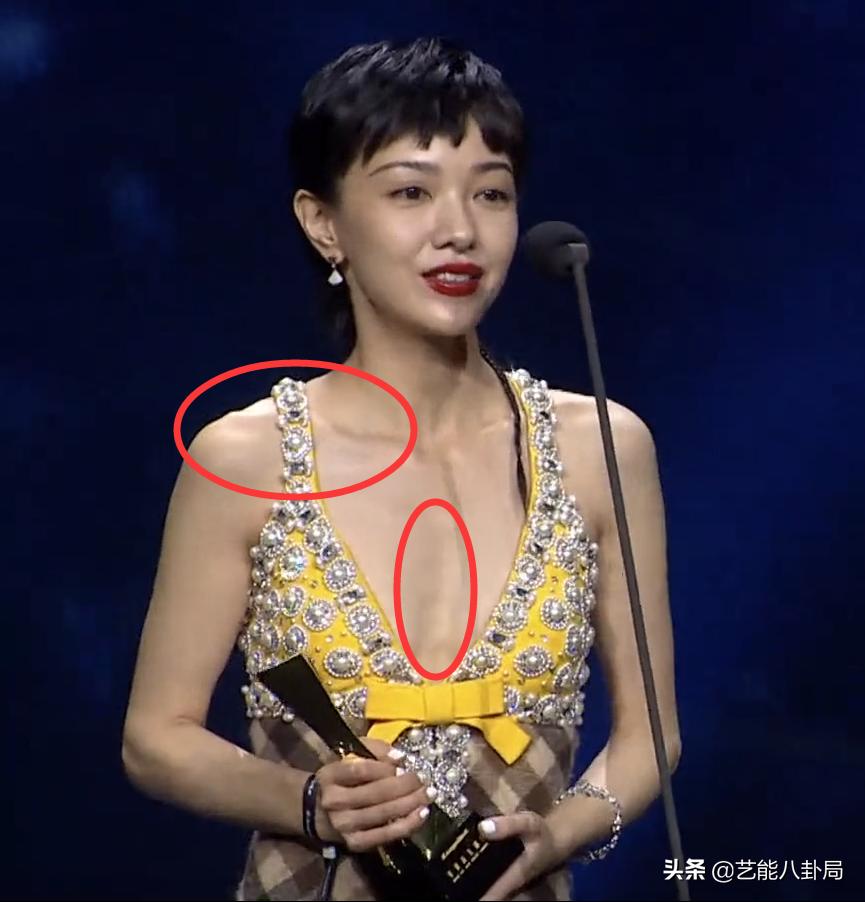 瘦脱相式衰老的7位女明星,瘦脱相的明星照片