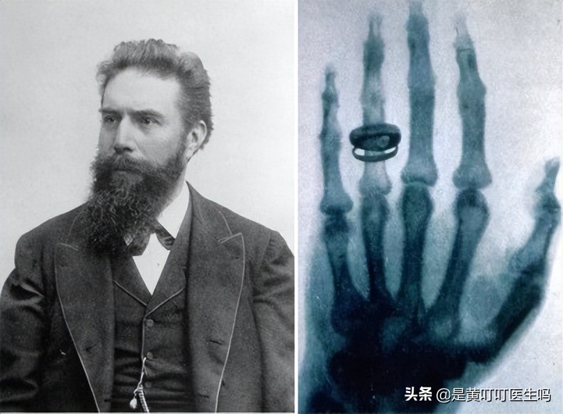 放射科医生告诉你——医院里哪些检查有辐射?