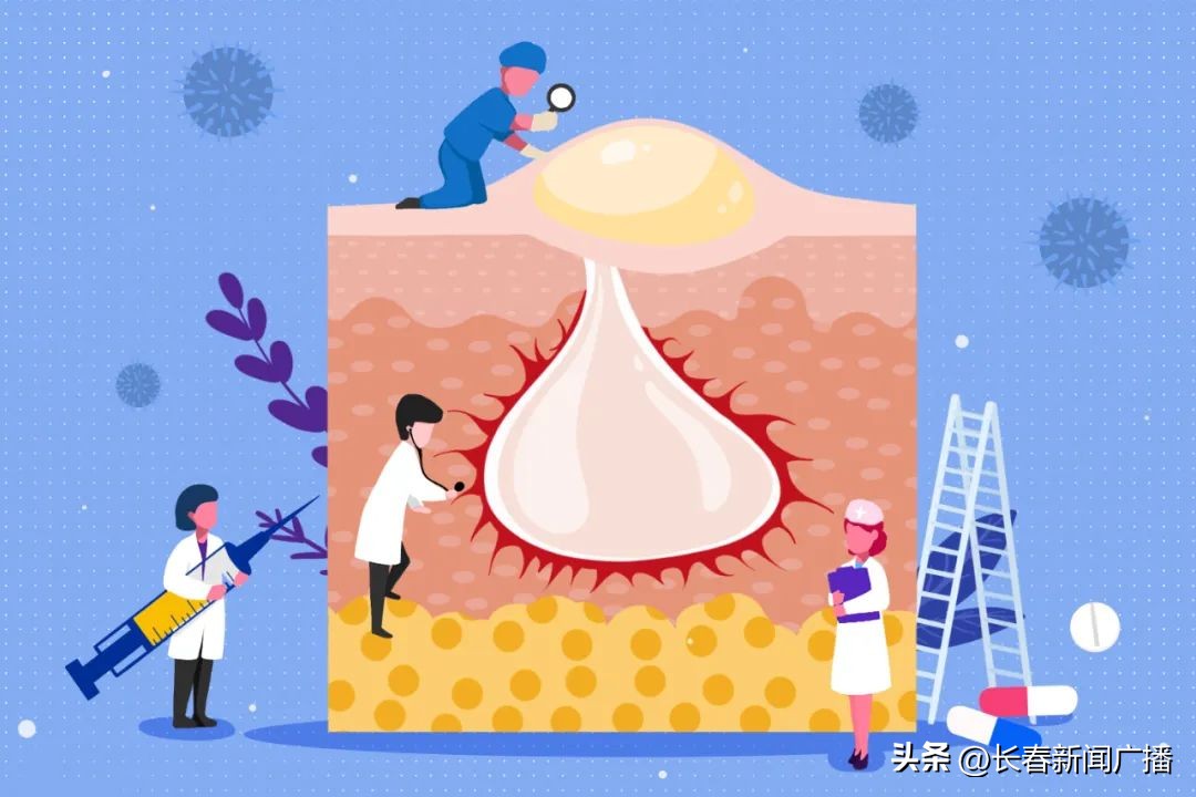 共建卫生城市共享健康成果|春季干燥，为什么孩子还长青春痘？