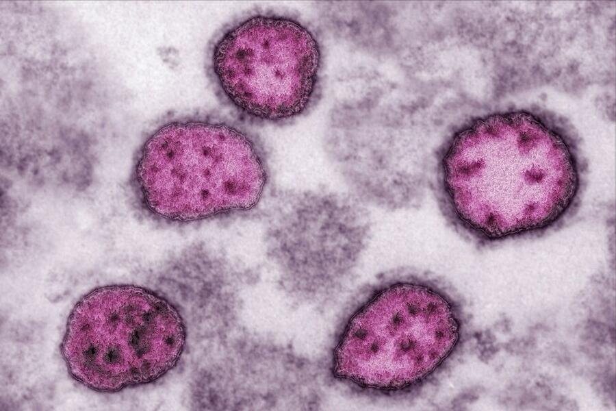 hpv高危和低危的区别是什么？尖锐湿疣能根治吗？