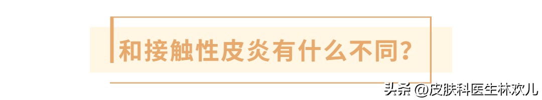 【日光性皮炎攻略】夏天想去海滩晒阳光浴？教你如何保护好自己！