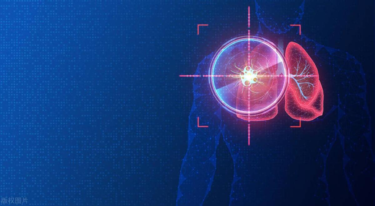 肺癌靶向药和幽门螺旋杆菌药物,肺癌淋巴癌晚期口服什么靶向药