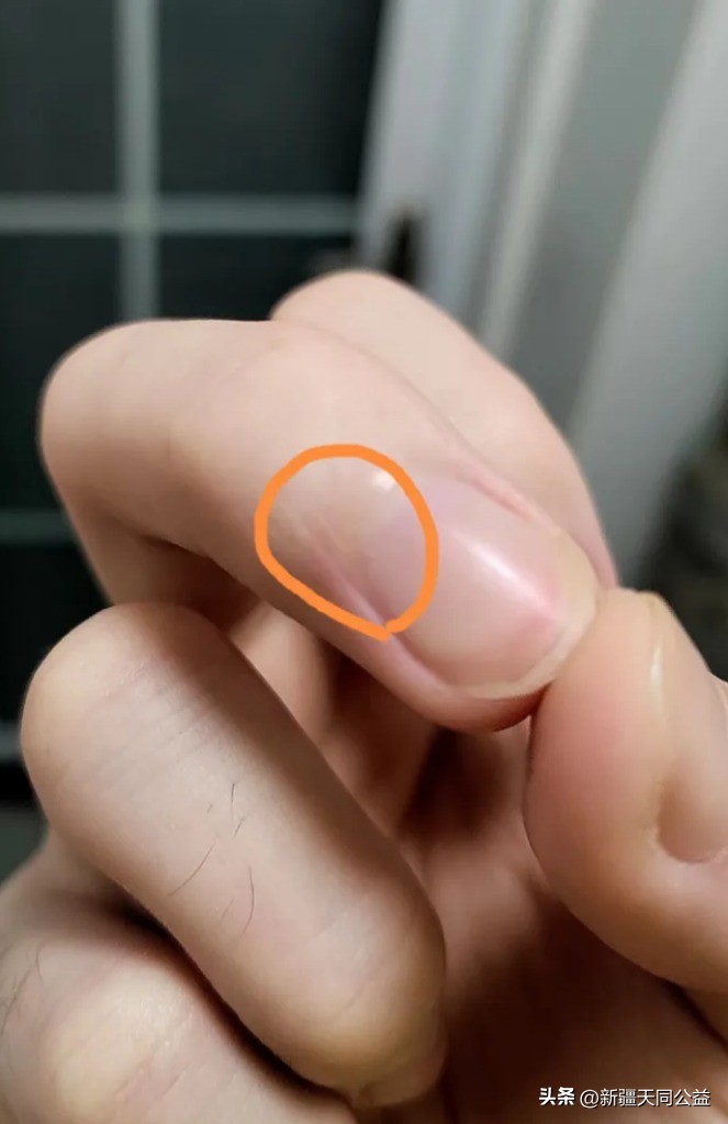 你们是怎么发现感染艾滋的,你是如何发现自己感染艾滋的知乎