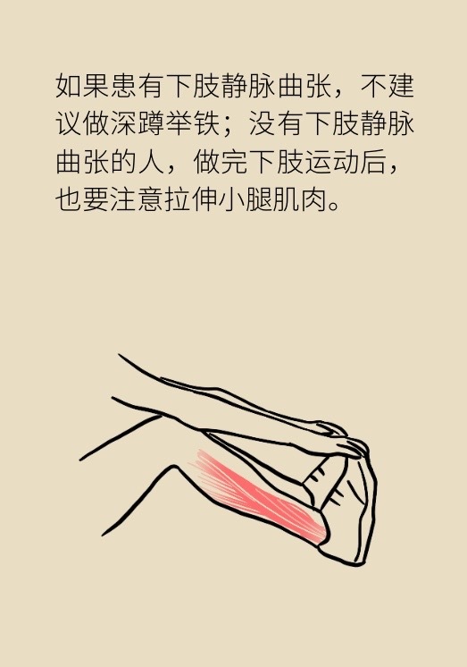 静脉曲张能自愈吗,静脉曲张0级到6级图片