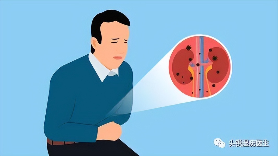 尖锐性湿疣和系带丘疹的区别,男性系带旁腺增生和尖锐湿疣的区别