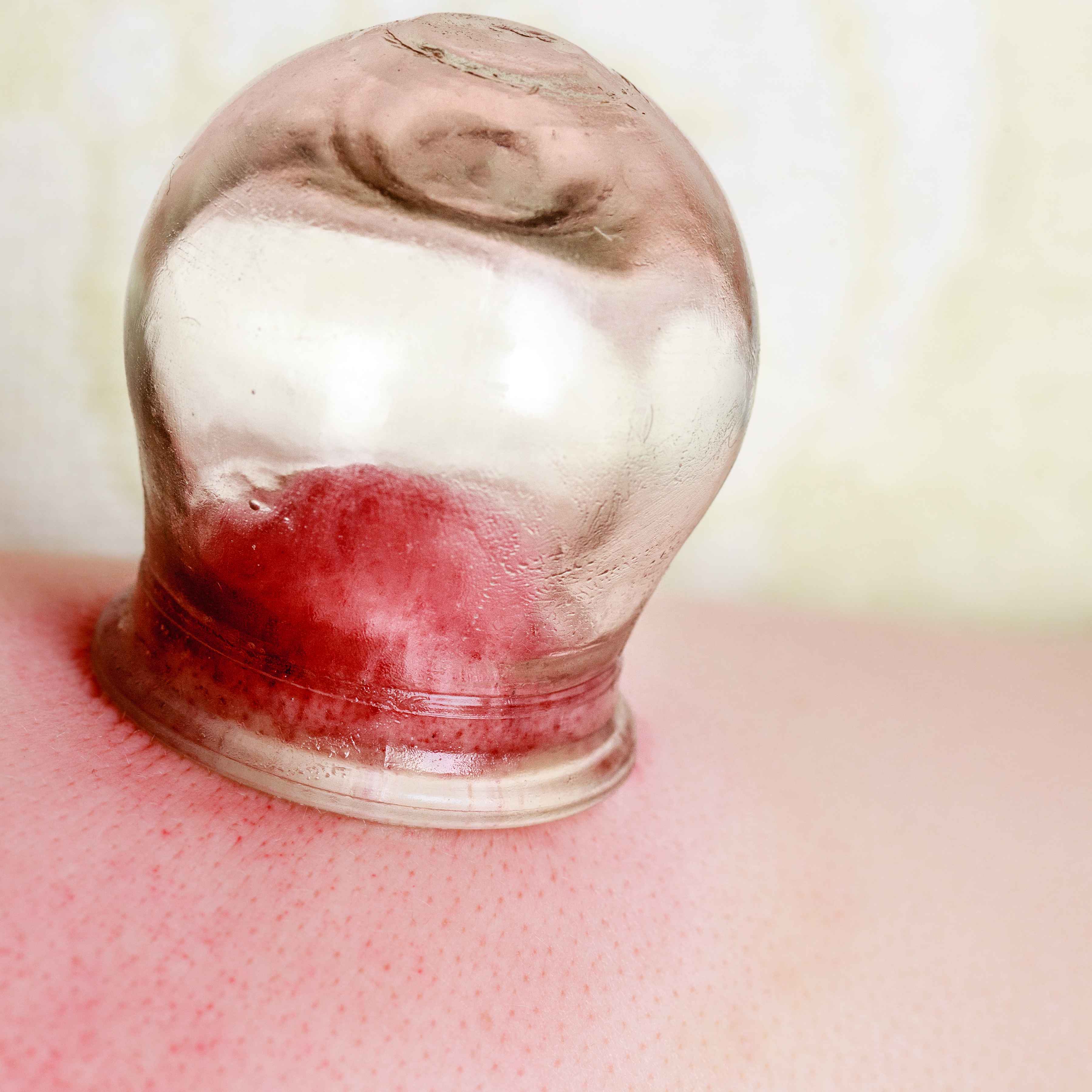 头发脸部爱出油是什么原因,头发和身体老是出油怎么治疗