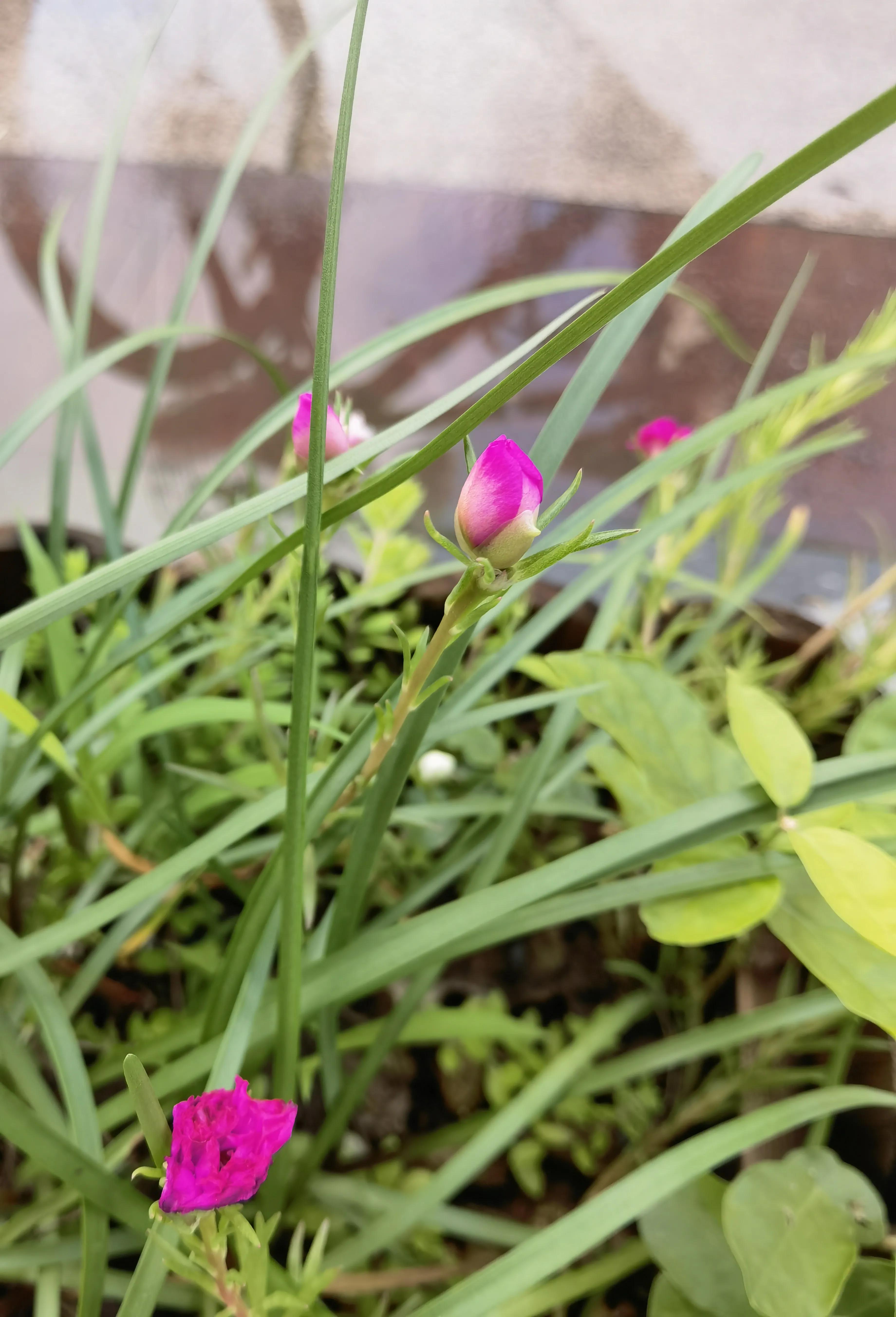 结石的痛苦有谁懂,结石的痛怎么缓解