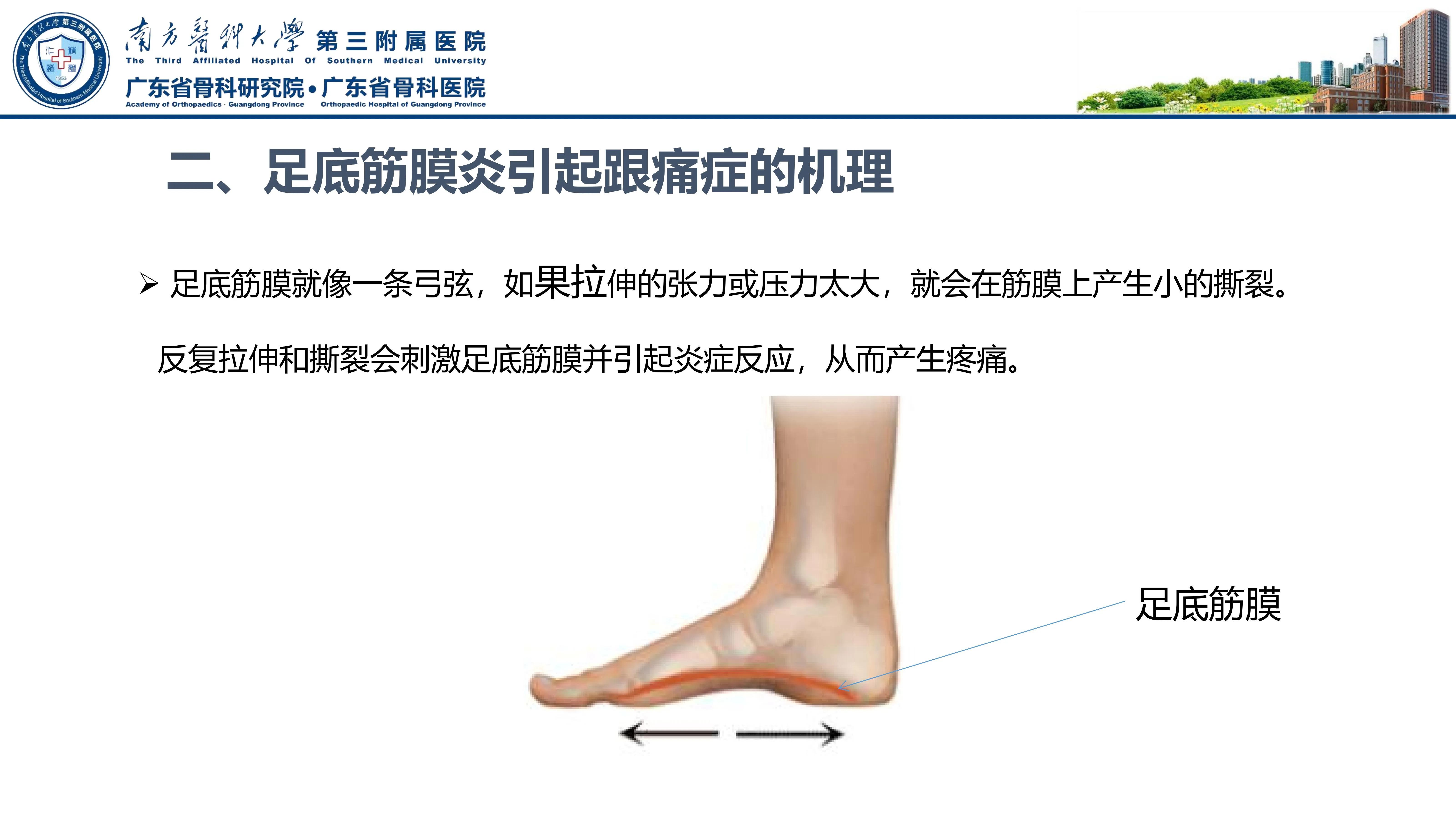 足底跖筋膜炎中间疼,足底筋膜炎疼痛治疗方法