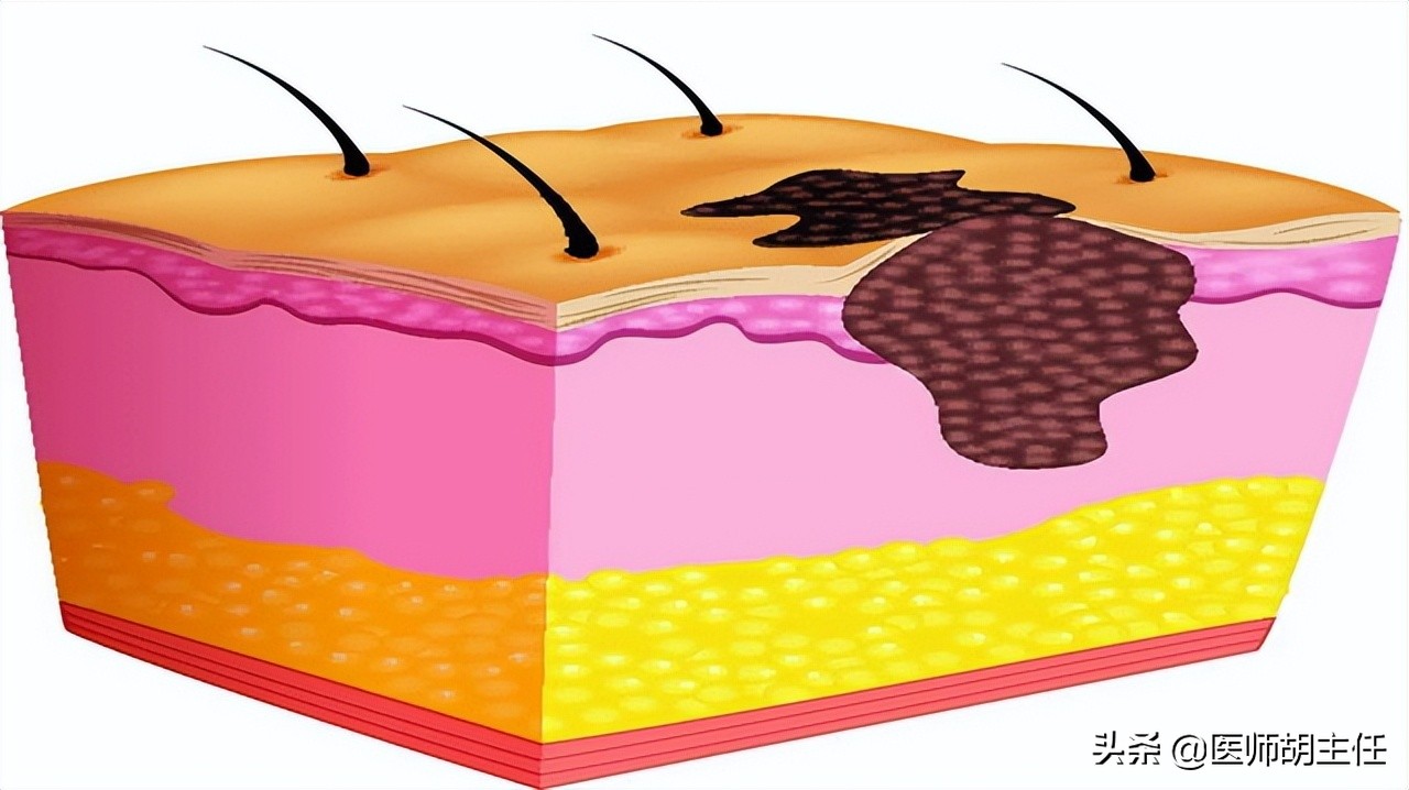 白头发增多是缺乏什么营养,白头发增多是缺少什么营养素吗