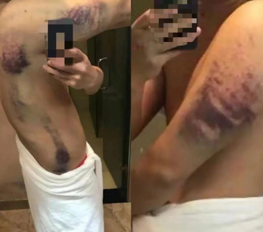 缅北风云：现实版人间地狱，“我”曾在那里失去一切！真实故事