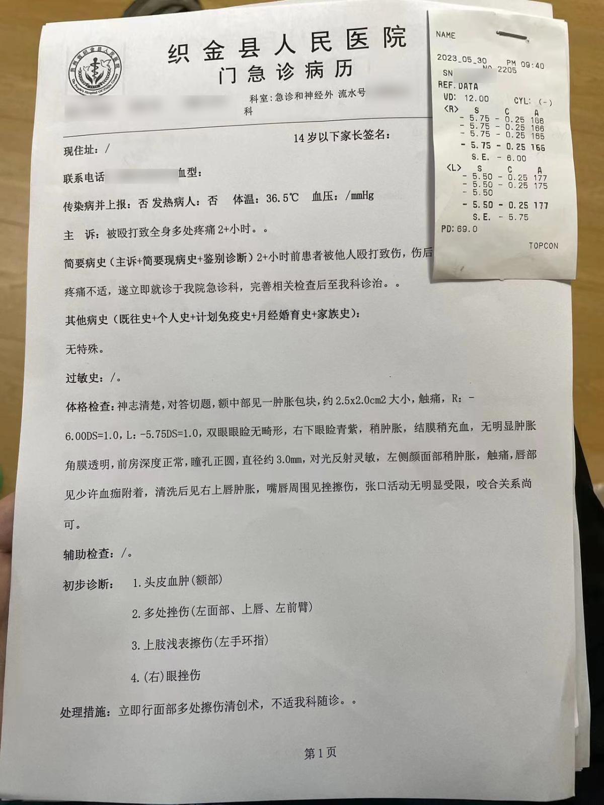 阿拉丁被抓后续,阿拉丁被尤达尔打一拳