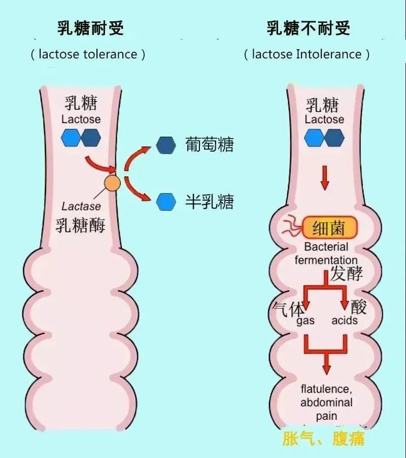 乳糖不耐受的人适合喝酸奶吗,每天喝酸奶身体会怎么样