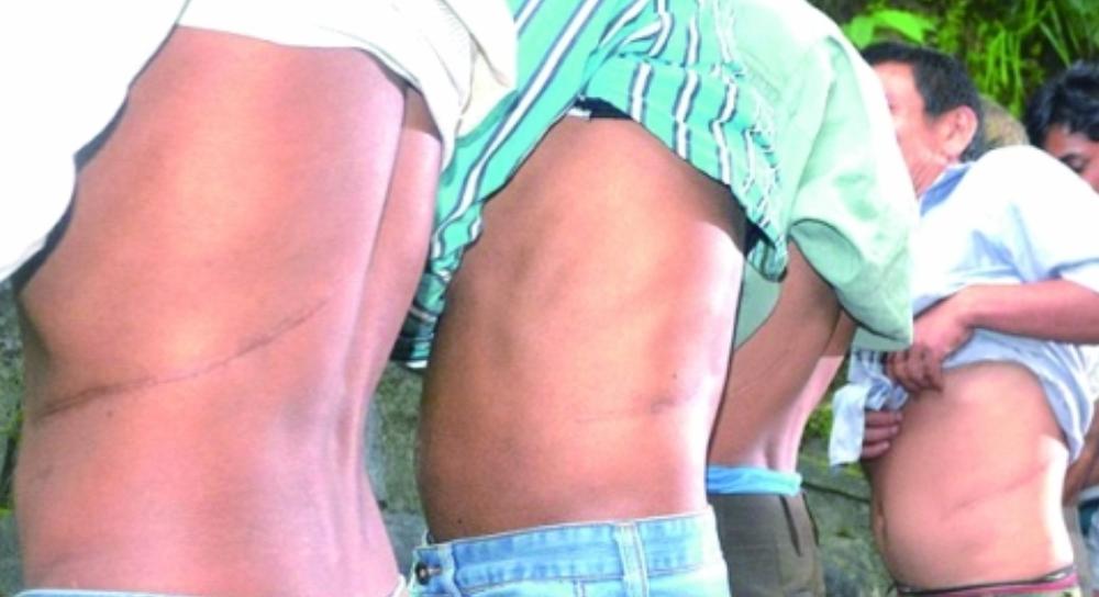 *体器人官**在美国*市黑**里被明码标价，为啥肾脏是最贵的器官？