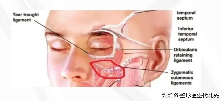 印第安纹形成的原因，印第安纹怎么去除效果最好？