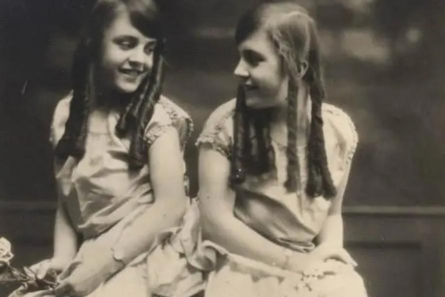 英国连体姐妹分离手术大结局,英国连体姐妹姐姐死后怎样