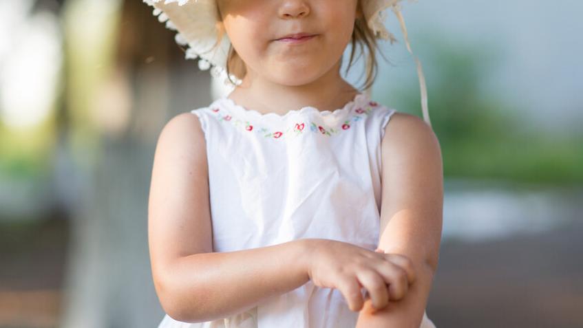 使用炉甘石的注意事项,炉甘石洗剂用法用量注意事项