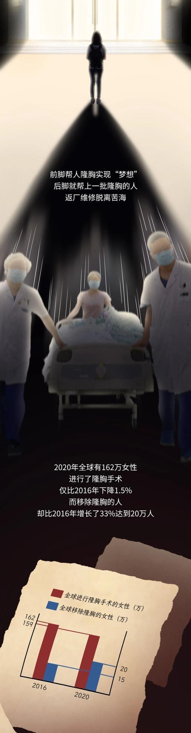 第一个隆胸的女人,第一个假体隆胸的人