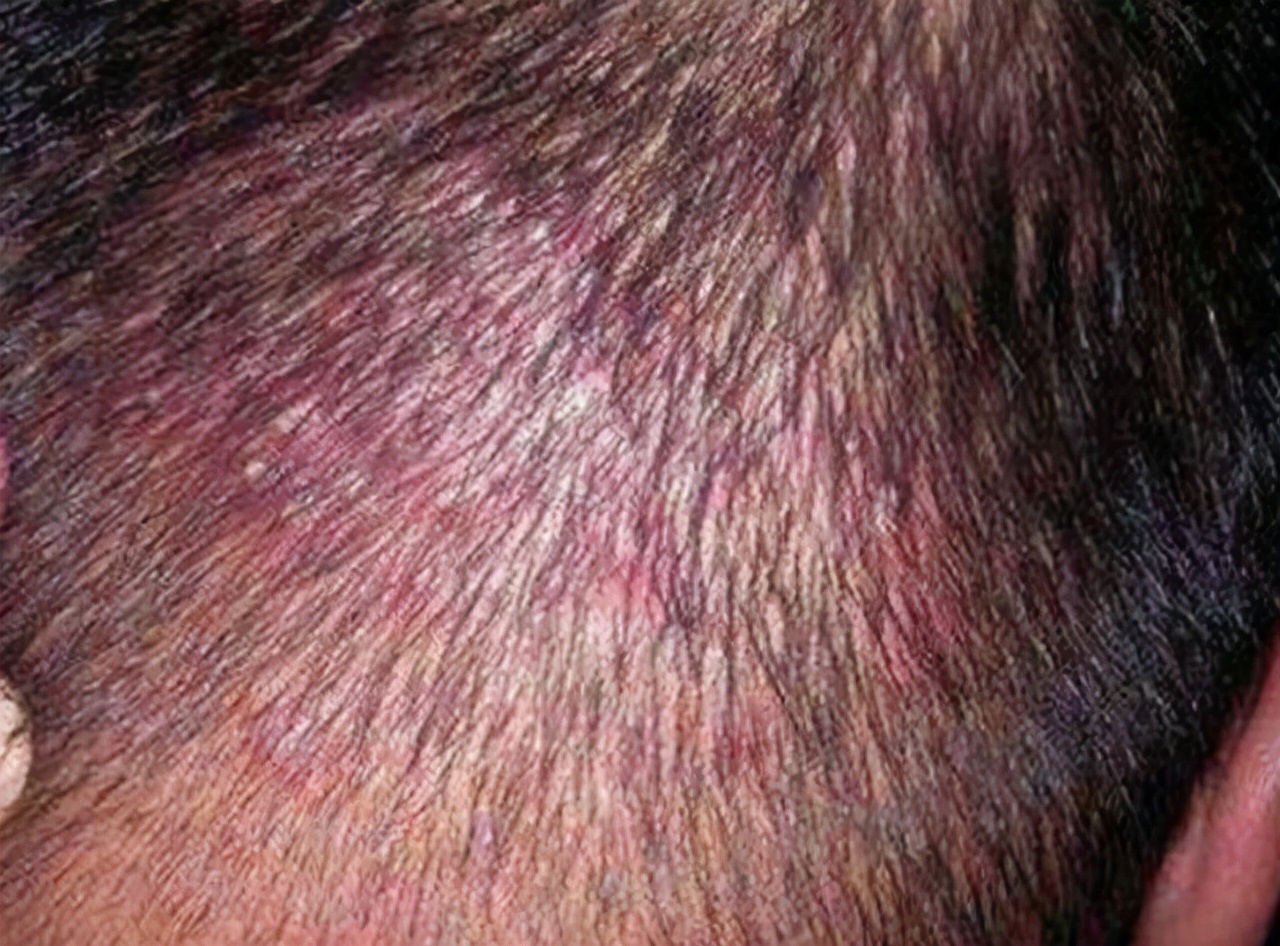 这些生发误区你还在做吗,这些防脱发产品你值得拥有