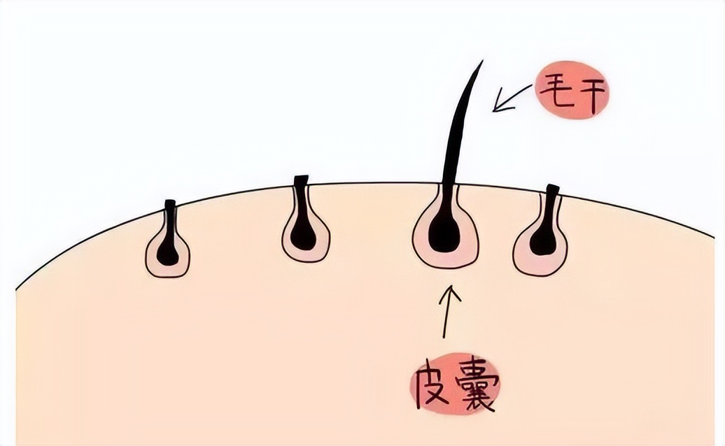 为什么头皮长痘痘和脓包,头皮上长小疙瘩脓包是怎么回事