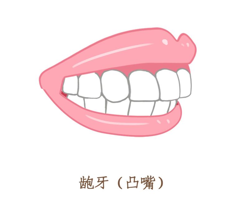 7岁小孩睡觉张嘴打鼾,5岁小朋友打鼾