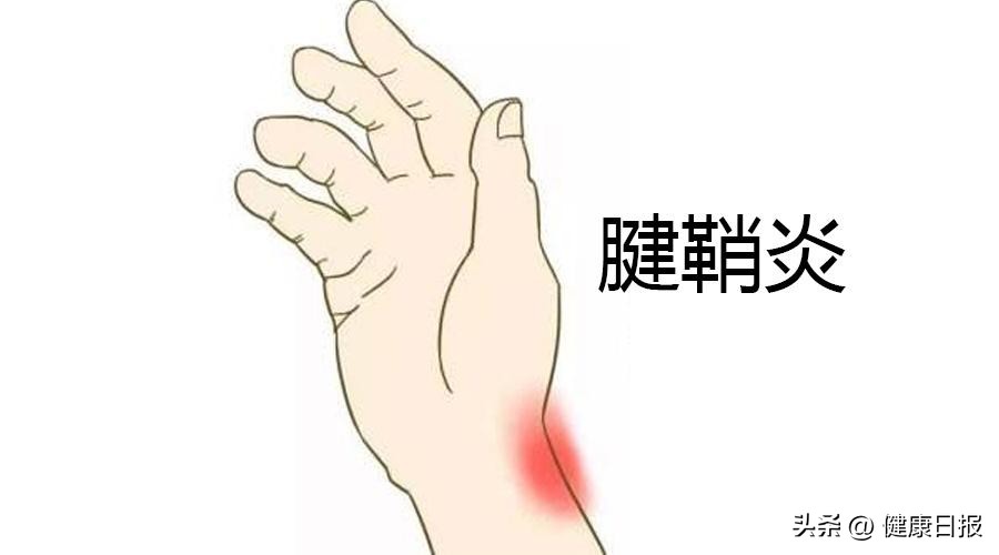 鼠标手和妈妈手都是腕管综合征吗,鼠标手和妈妈手