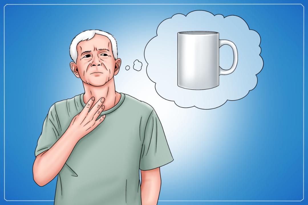 干燥综合症口干眼干多久能缓解,干燥综合征北京专家