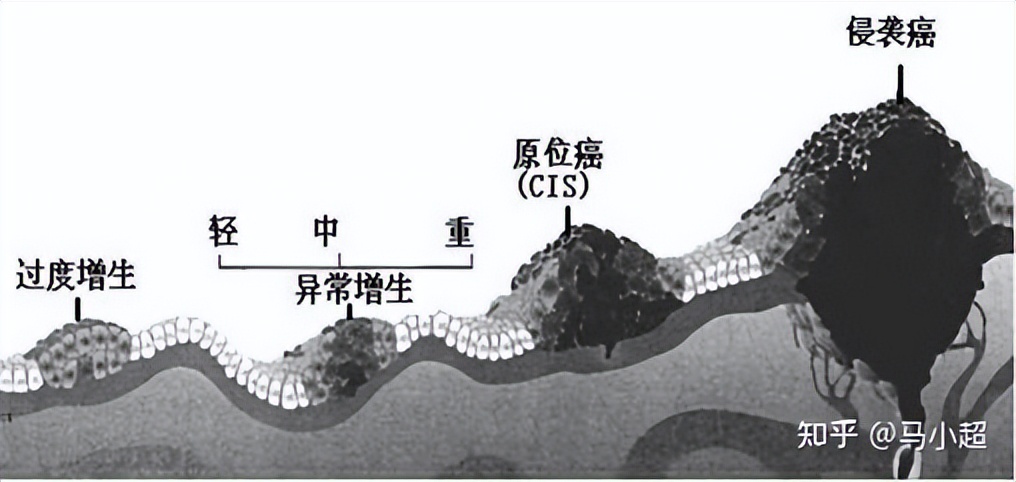大黄蜂7号有必要换8号吗,大黄蜂7号跟10号哪个好一些