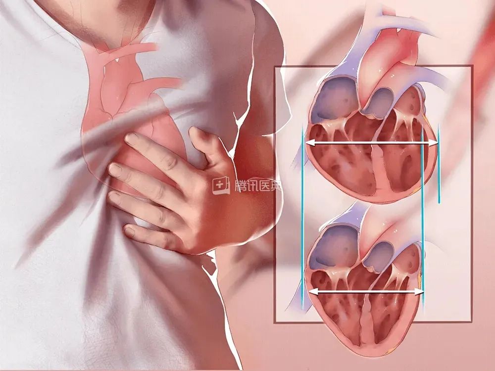 深圳龙华哪个医院治疗心梗,脑梗心梗深圳医院最好