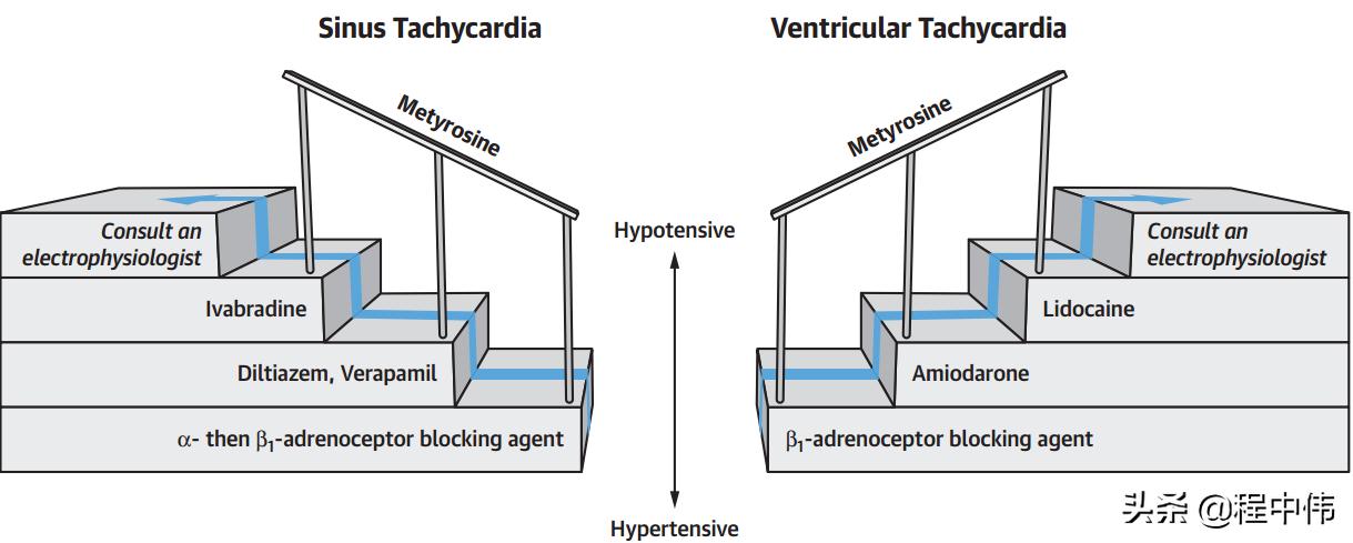 嗜铬细胞瘤出现心慌会长多大,嗜铬细胞瘤心动过速的原因