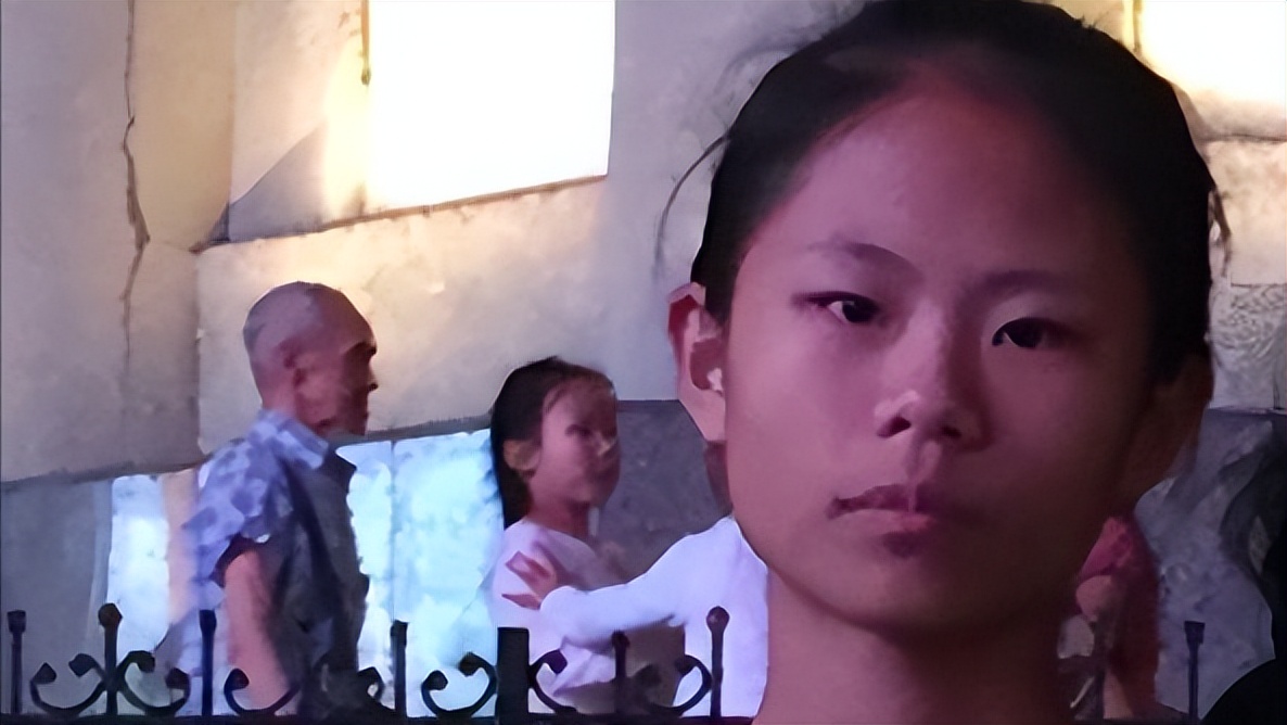 整容狂人整容100多次,整容狂魔手术200次