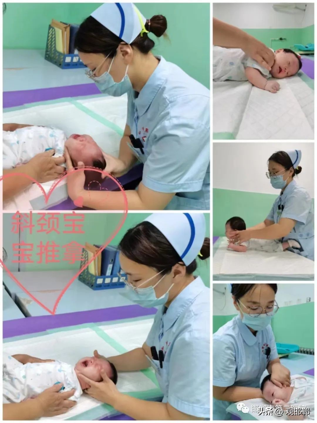 宝宝斜颈往右偏如何纠正睡姿,斜颈宝宝如何矫正睡姿图片