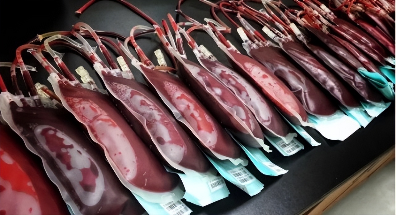 换血疗法真的能让人年轻吗,年轻人换血实验结果