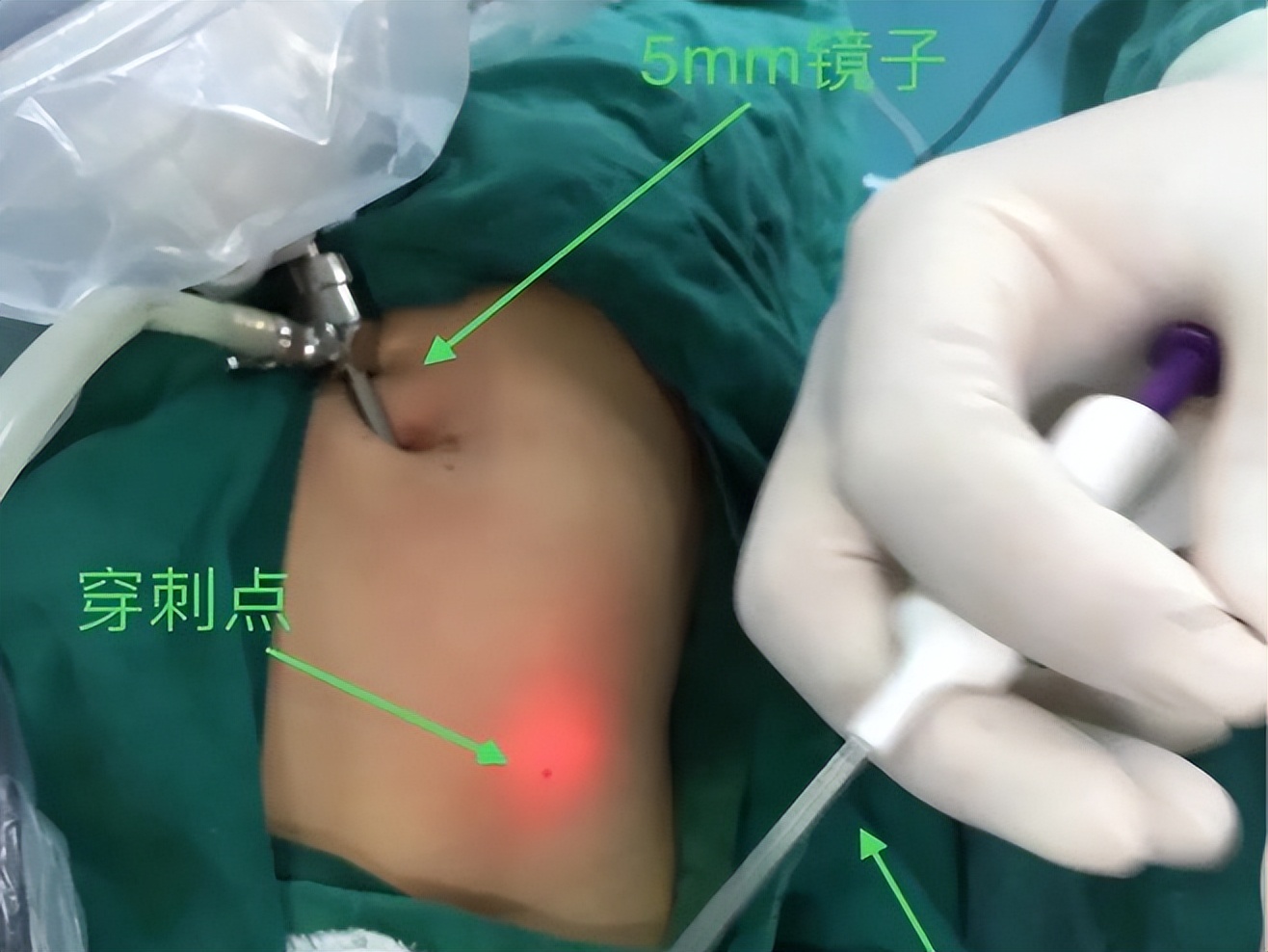 小男孩老是肚子痛怎么回事,男孩小肚子疼是小肠换气吗