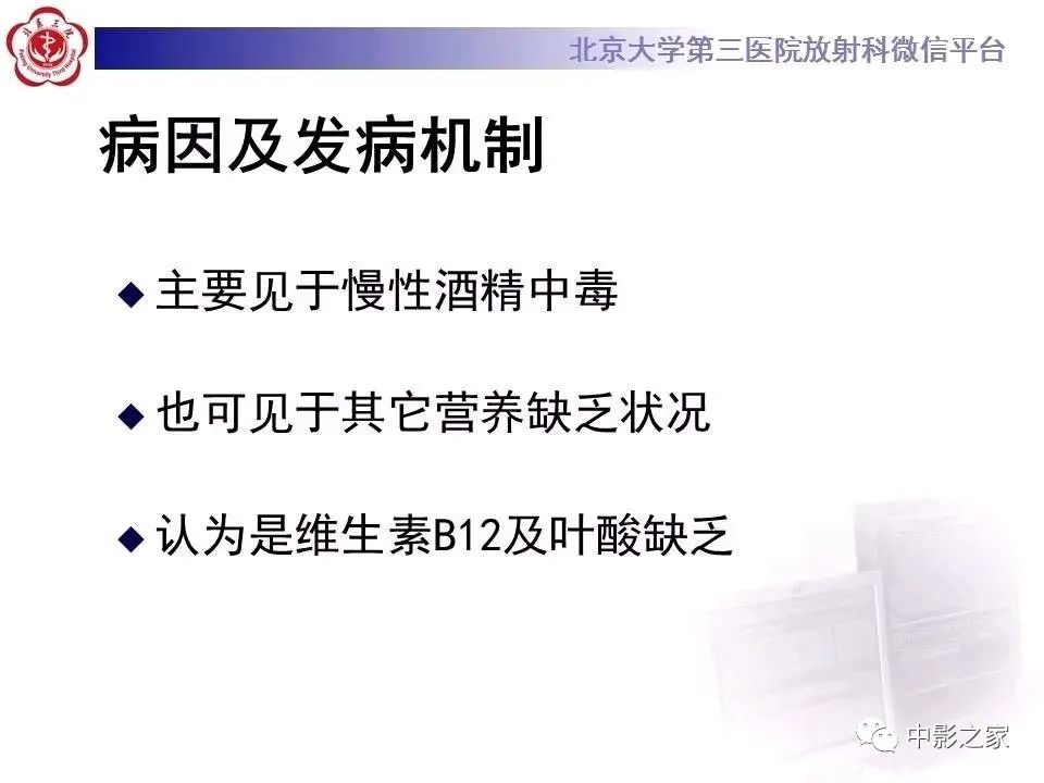 什么叫原发性胼胝体变性,原发性胼胝体变性治疗多少钱