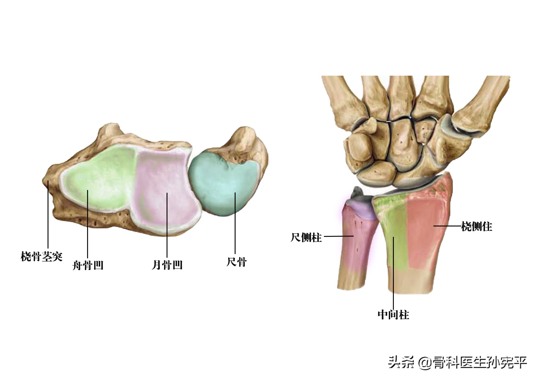 桡骨近端骨折和远端骨折哪个严重,桡骨远端骨折属于colles骨折吗
