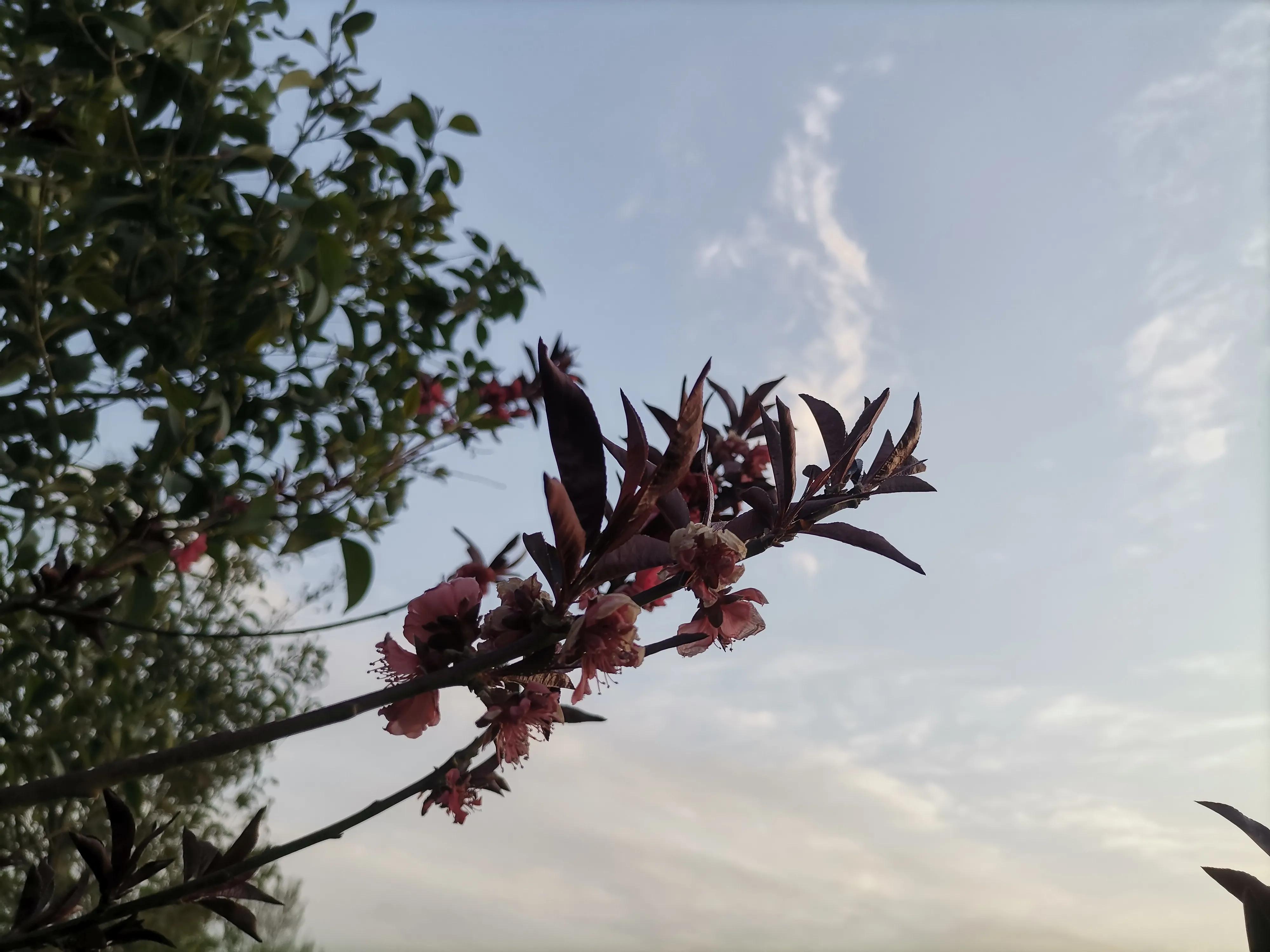 神经内科常见病及用药,神经内科缺血性脑血管疾病