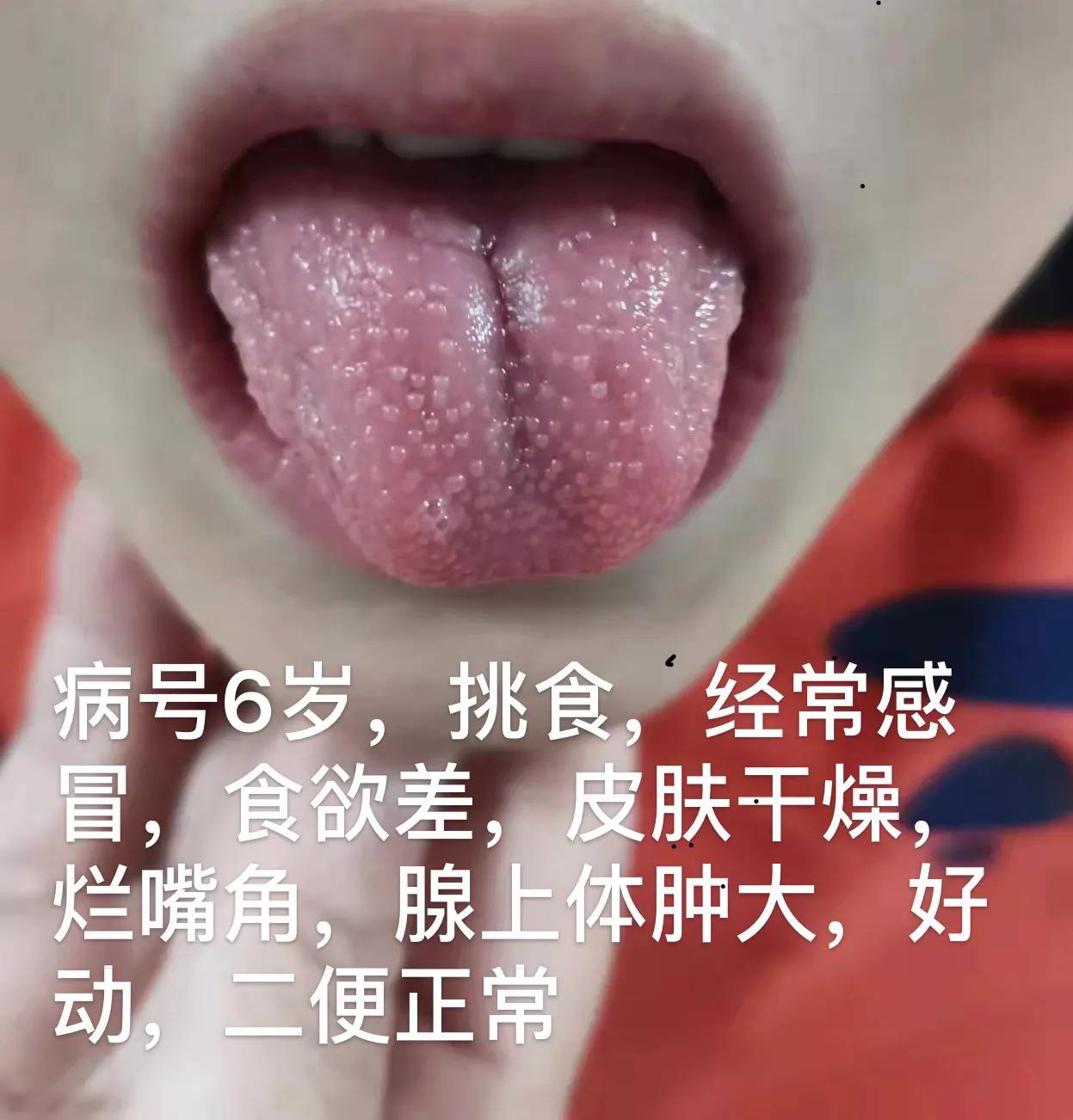 宝宝晚上睡个觉翻来覆去折腾，不睡觉，趴着，撅屁股睡，磨牙