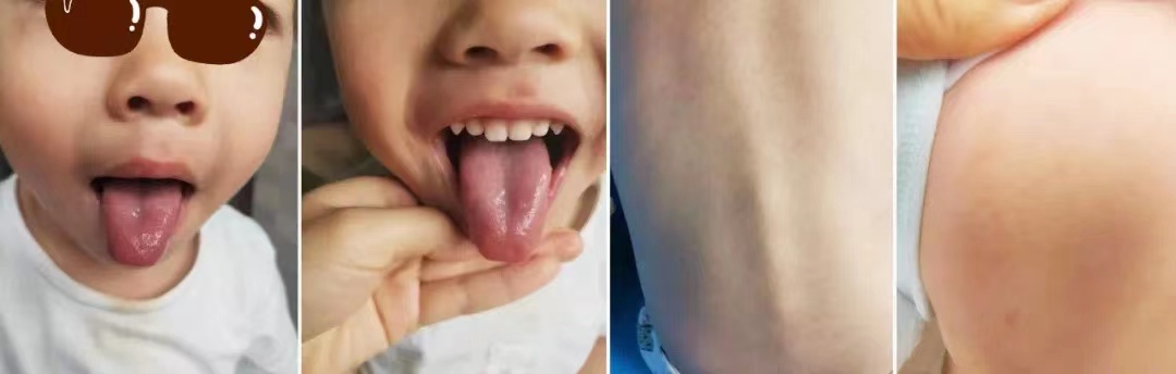 羊便秘拉不出来屎怎么办,小孩便秘羊屎蛋怎么治