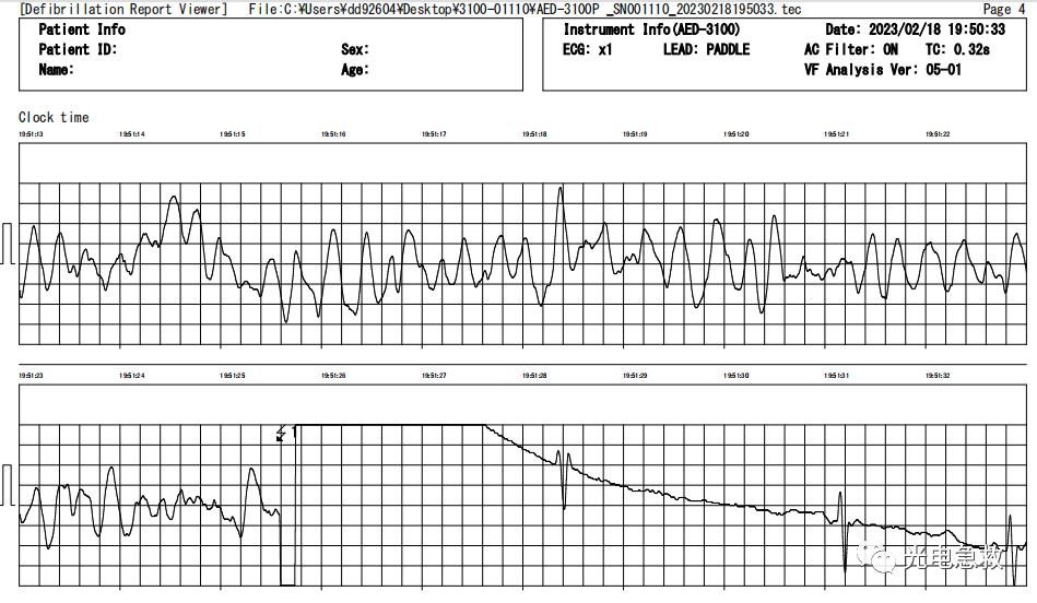 2004足球运动员心脏骤停事件,足球心脏骤停对手帮忙抢救