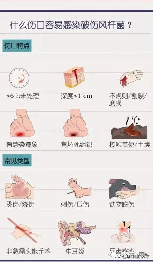 破伤风是伤口受风引起吗,破伤风是伤口吹风引起的吗