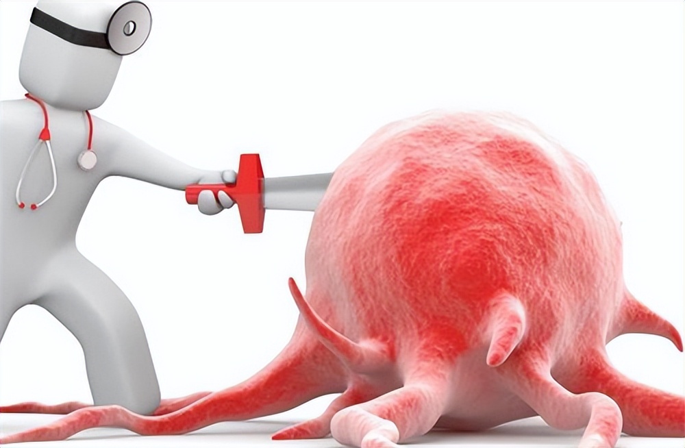 国产治癌利器研制成功,中国治癌新方法费用多少