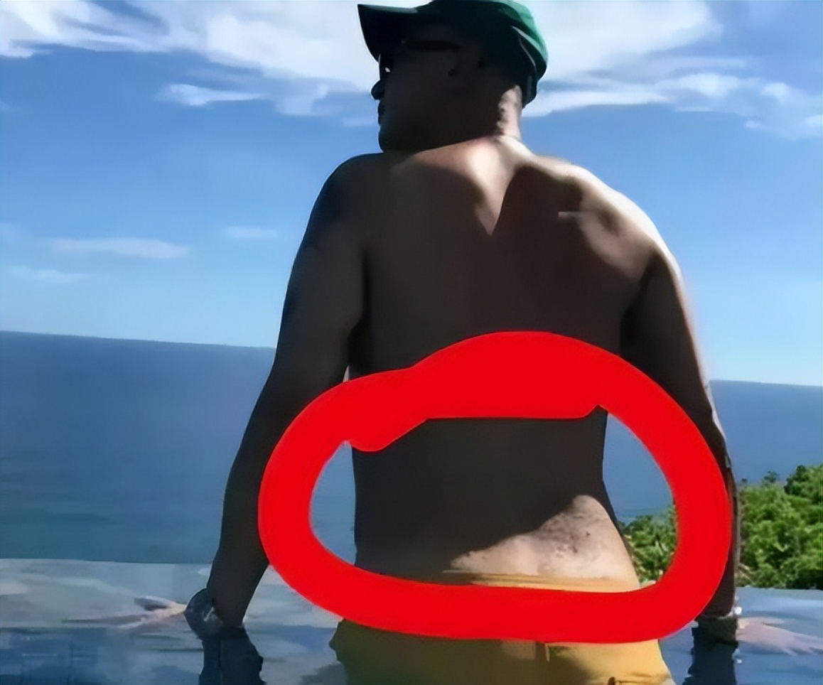 具俊晔被爆有隐疾,具俊晔是否有湿疣