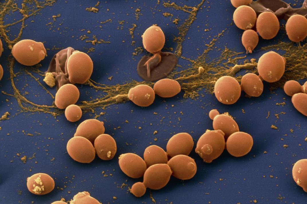 内衣经常湿的会引起疾病吗,内衣湿湿的是怎么回事