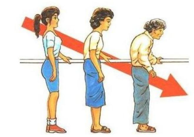 老年人不幸摔了骨折怎么调养好,老人轻微骨折怎么处理