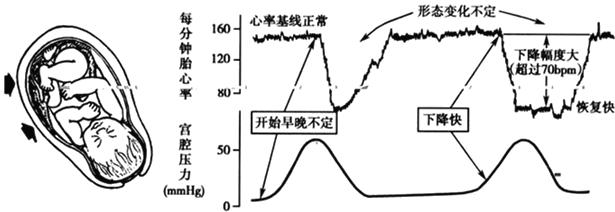 孕妈妈需要经历什么,从怀孕到生需要做多少次产检