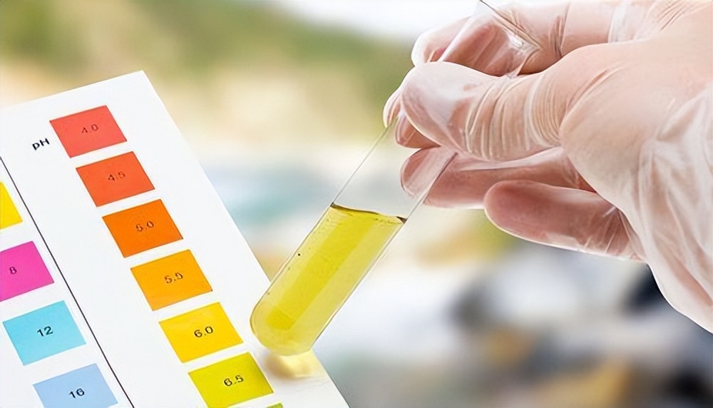 尿潜血试验阳性尿白细胞阳性,尿潜血试验阳性吃什么药治疗