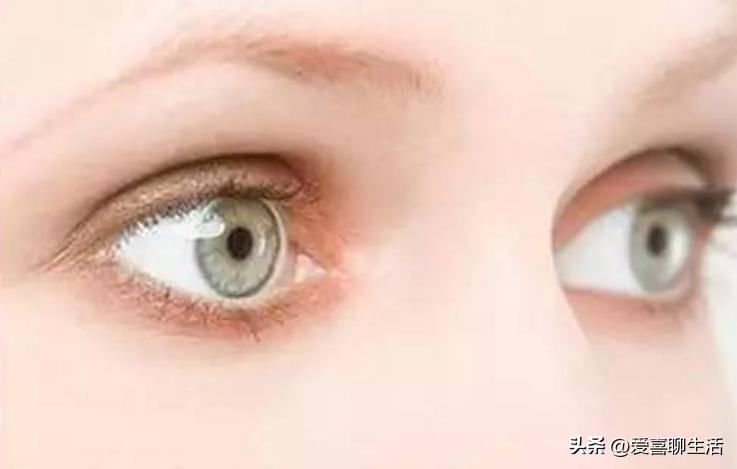 熬夜吃什么水果可以缓解眼睛干涩,专业保护眼睛干涩的神奇食物