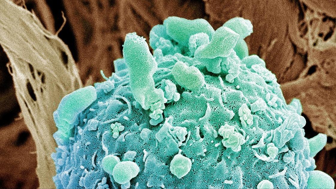 红霉素软膏能去除老年斑吗,红霉素软膏能治好老年斑吗